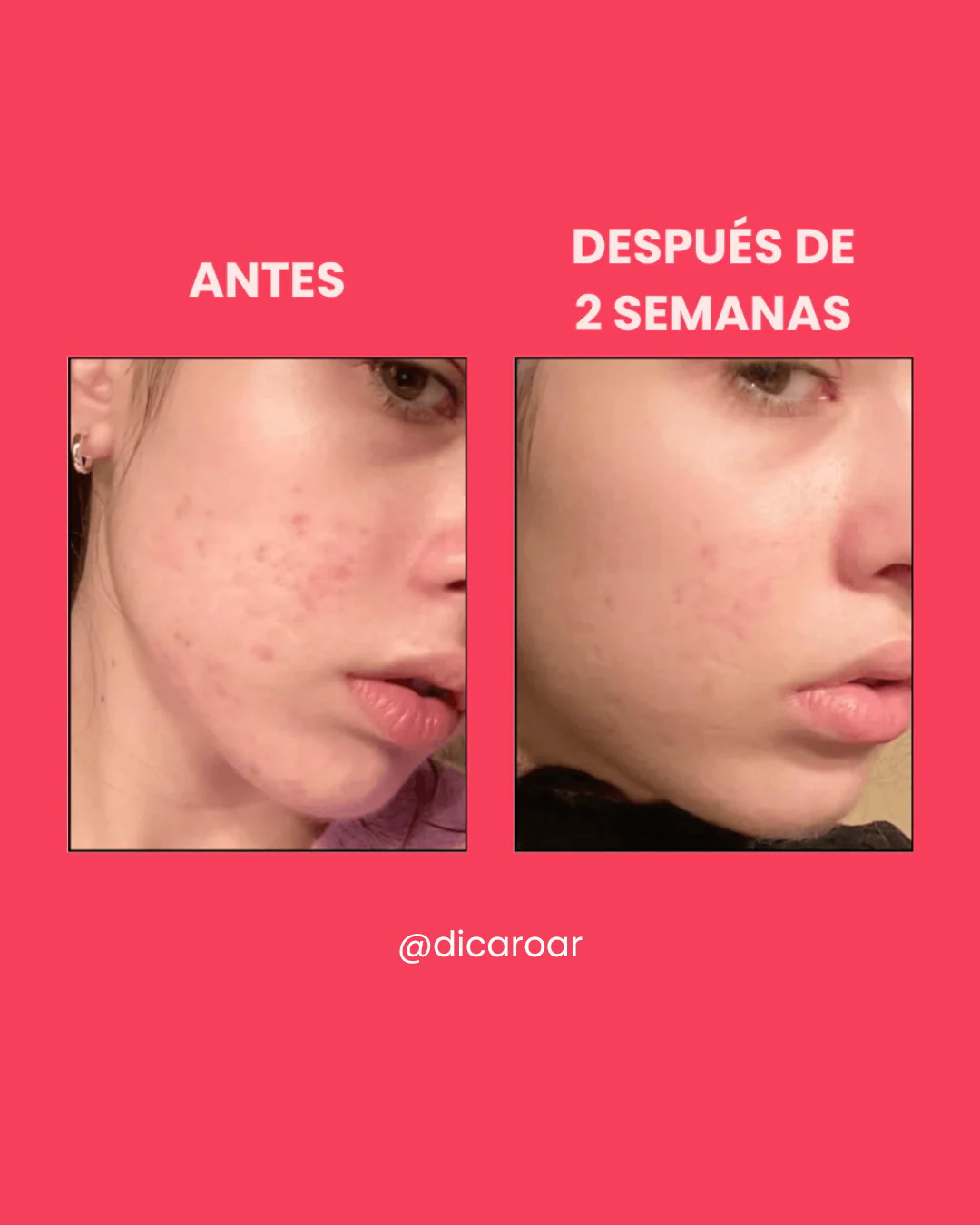 Anua Niacinamide 10% + TXA 4% Serum