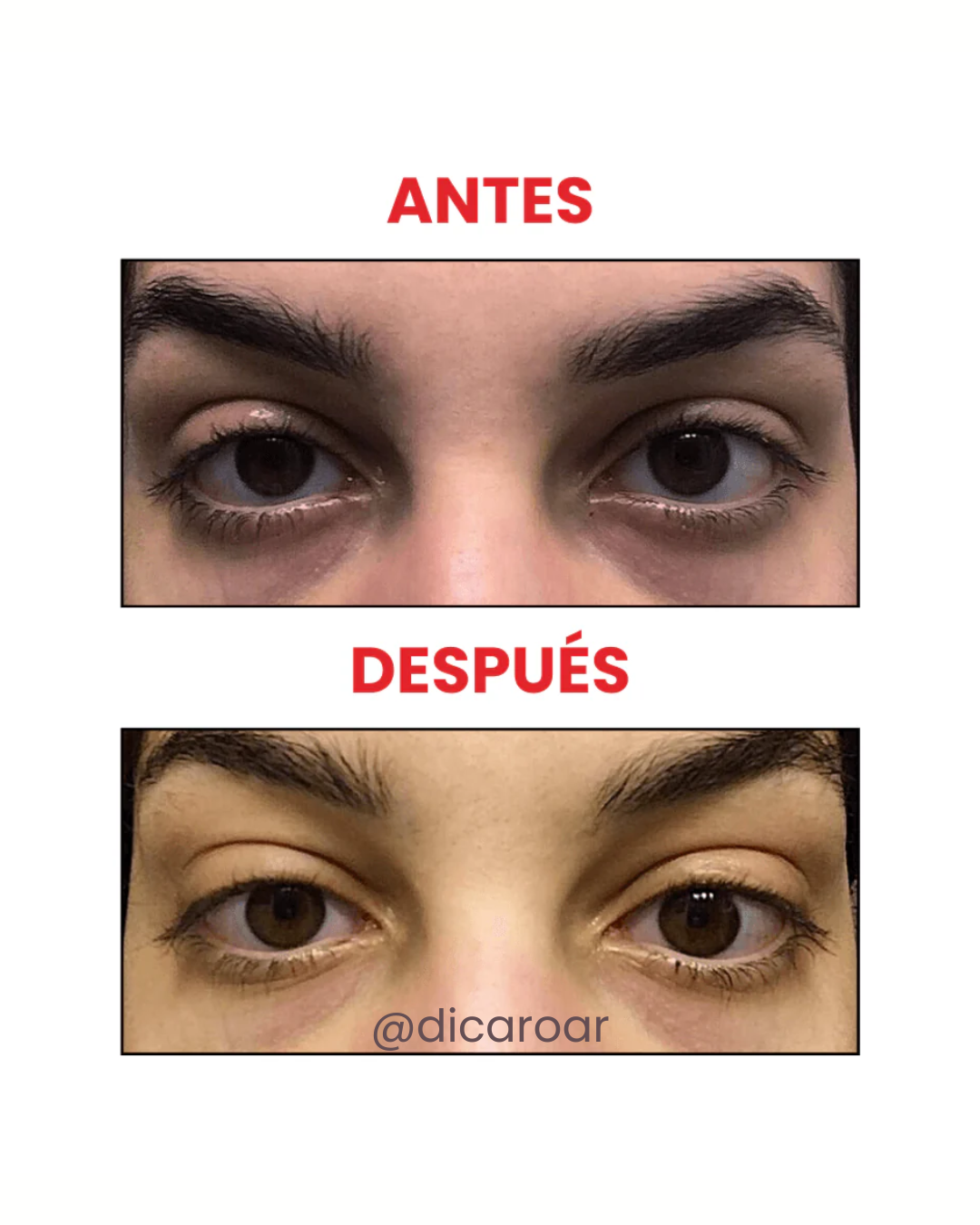 The Ordinary Caffeine solution 5% + EGCG