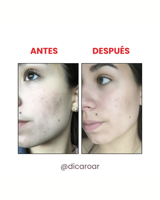 The Ordinary AHA 30% + BHA 2% Peeling solution