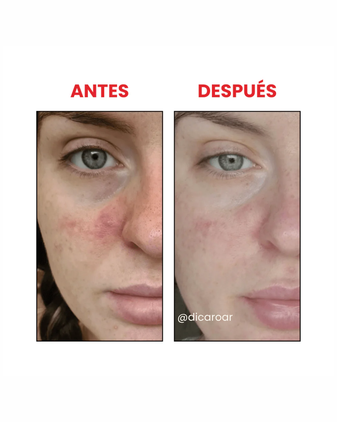La Roche-Posay  |  Retinol Serum B3 Serum Anti-arrugas